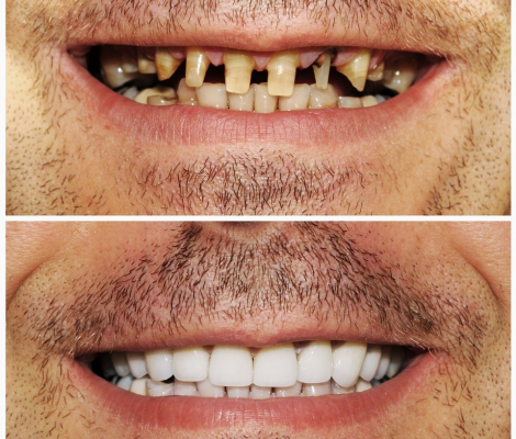 dentista-cantelli-Aversa-022